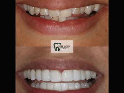 Smile transformation – 27