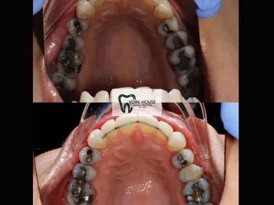 Smile transformation – 31