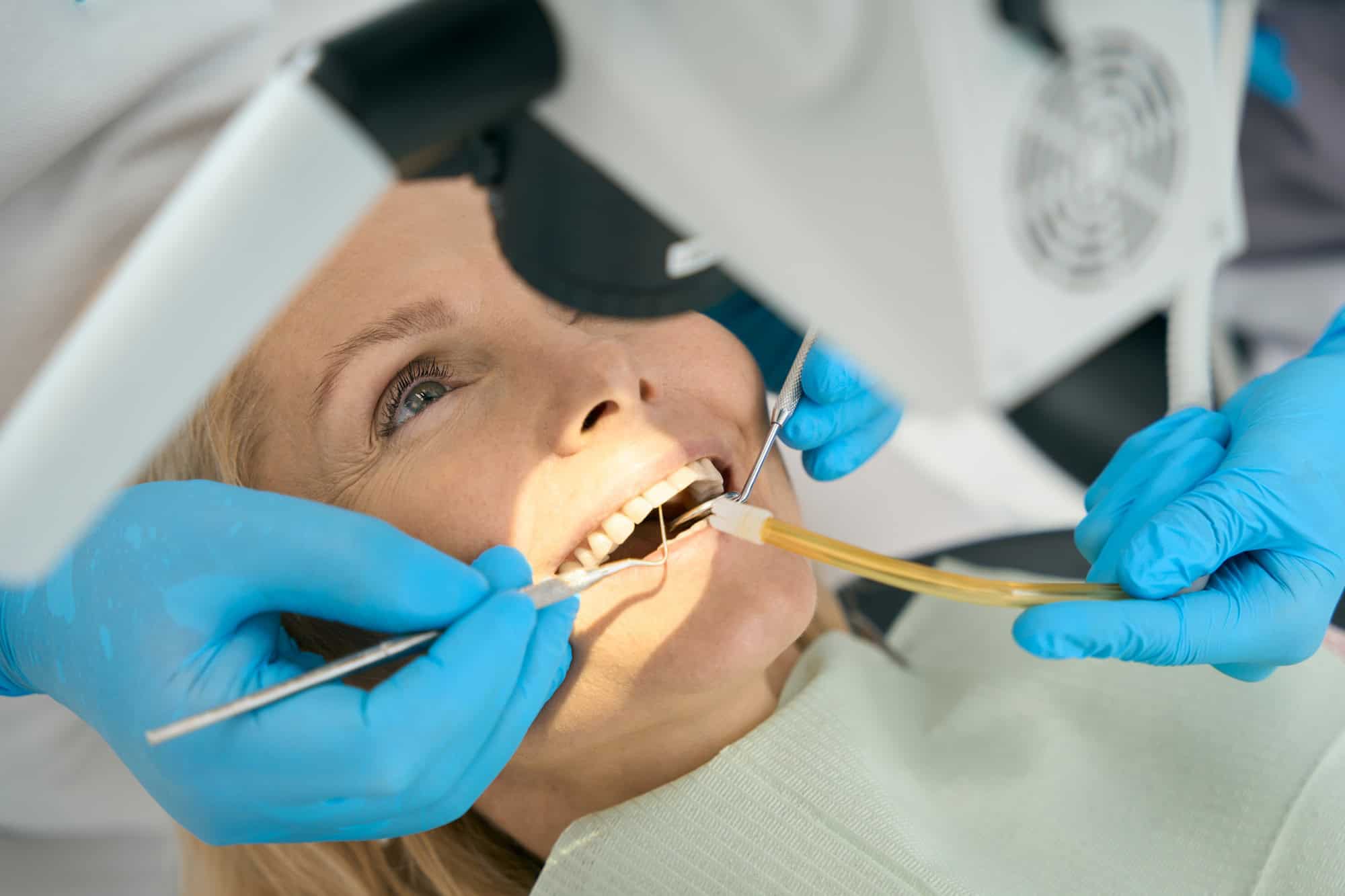 Dentist filling teeth with the special equipments