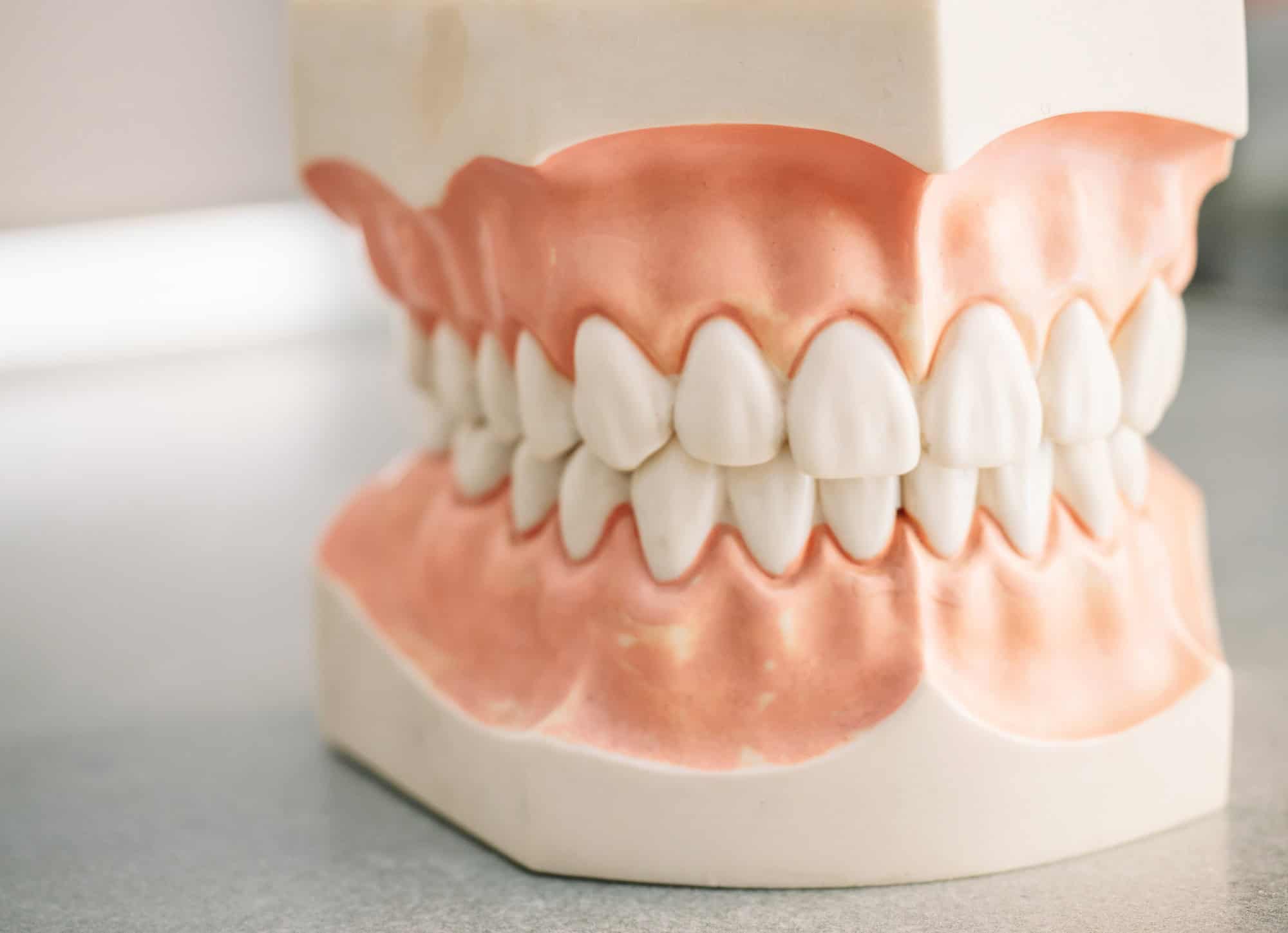 Mould of human teeth.